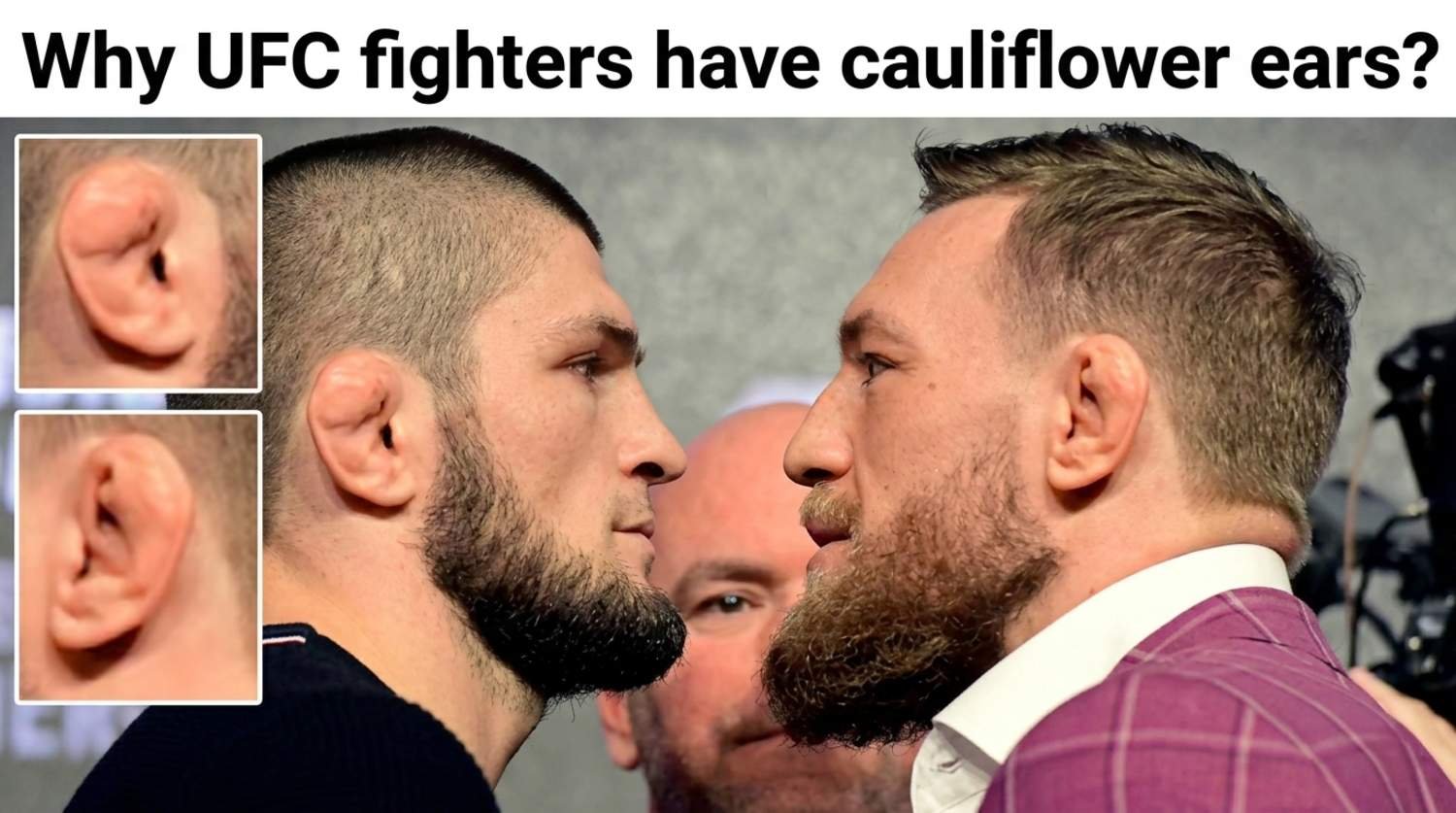 A side-by-side face-off between Khabib Nurmagomedov and Conor McGregor with close-up inset photos of cauliflower ears.