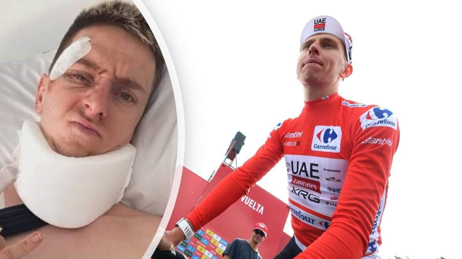 Tadej Pogacar during his recovery after suffering three fractured vertebrae and a concussion in the Vuelta a Espana crash.